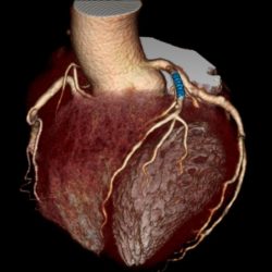 A 3D image of the heart, used as a link to our services page